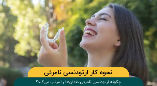 چگونه-ارتودنسی-نامرئی-دندان‌-ها-را-مرتب-می‌-کند